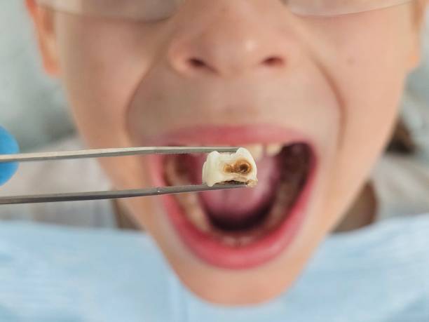 Best Emergency Tooth Extraction  in Forestbrook, SC